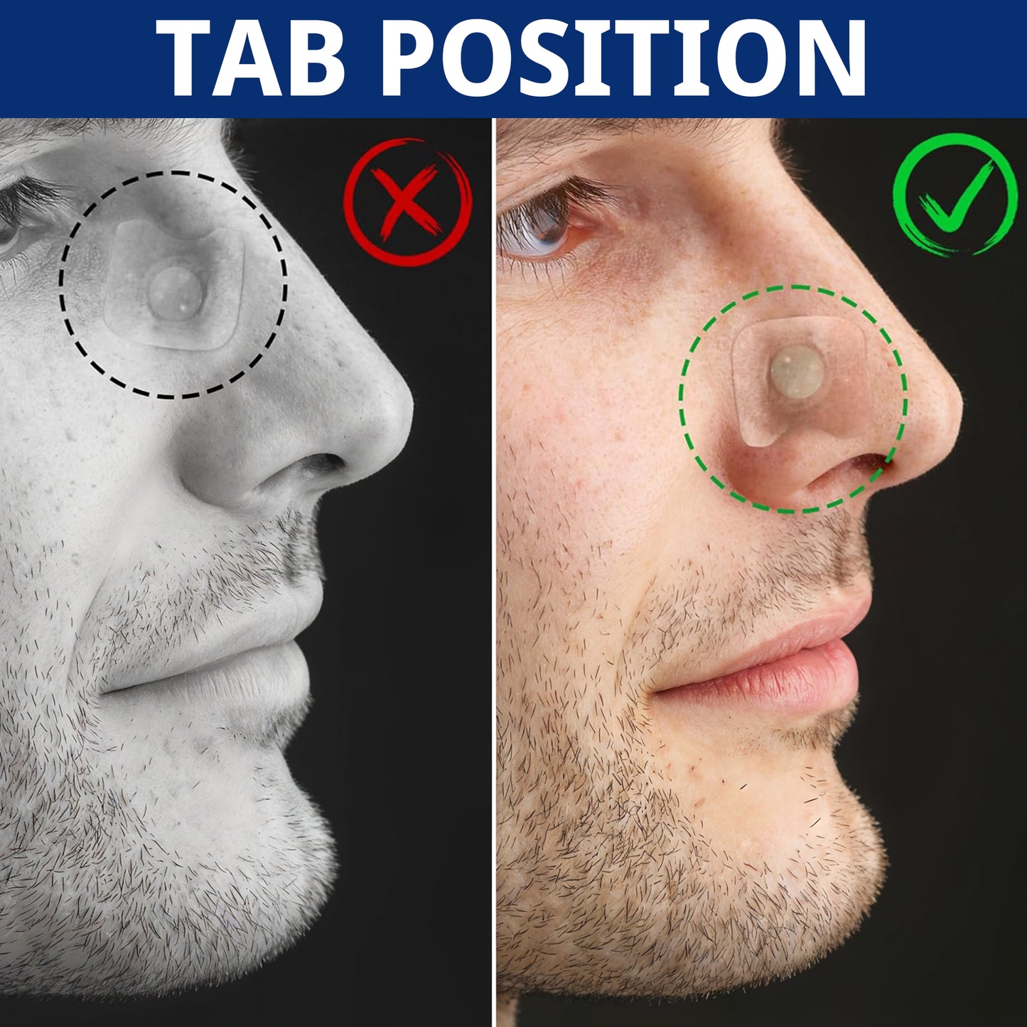 Magnetic Nasal Strips